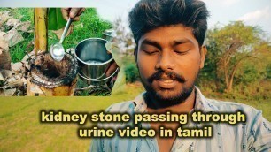 'kidney stone natural treatment in tamil | vlog | vijay vision'