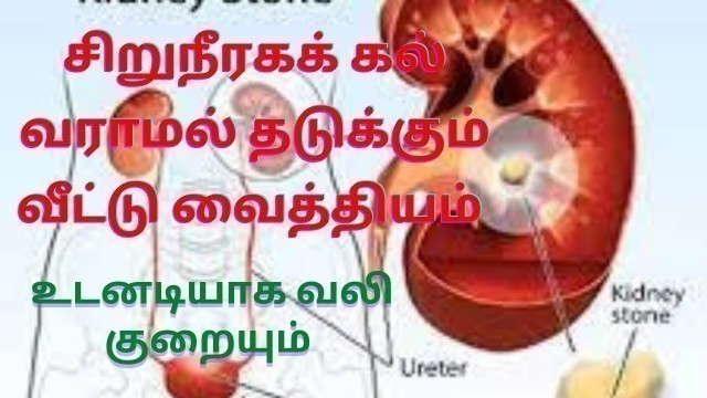 'kidney atone | சிறுநீரகக் கல் வராமல் தடுக்கும் வீட்டு வைத்தியம் | உடனடியாக வலி குறையும்'