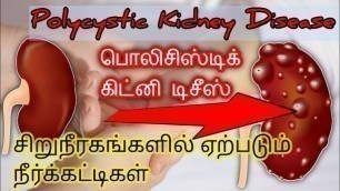 'Polycystic kidney disease Tamil/kidney failure symptoms in tamil/kidney failure treatment in tamil'