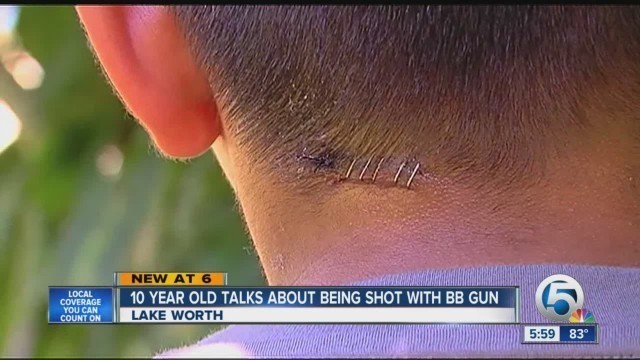 'Child shot in neck with BB gun'