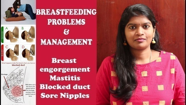 'COMMON BREASTFEEDING PROBLEMS AND MANAGEMENT PART-1  in tamil'