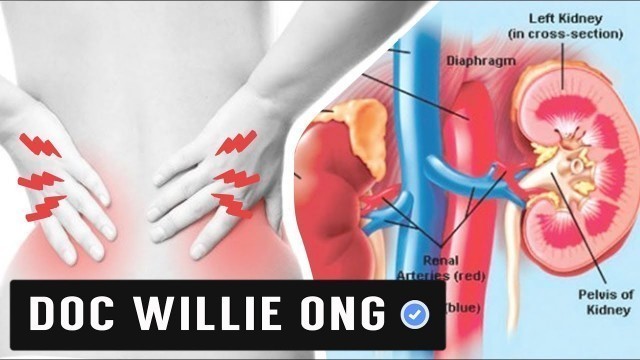 'CREATININE PABABAIN: Masustansiyang Pagkain - Payo ni Doc Willie Ong #555b'