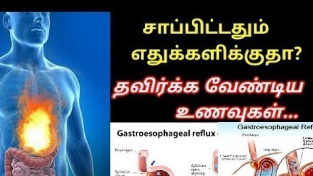 'Acid reflux diet | 7 foods to avoid if you have acid reflux | Tamil'